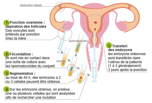 diagnostic_preimplantatoire_petit_format.jpg