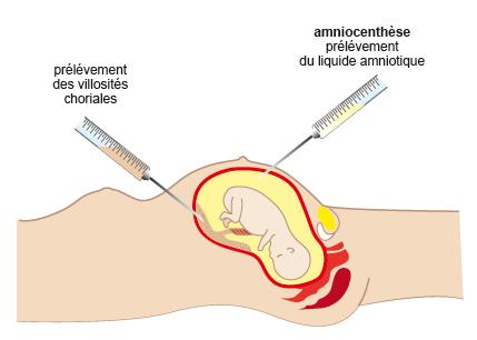 diagnostic_prenatal_petit_format.jpg