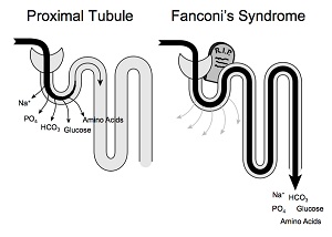 cystinose_vml_association.jpg